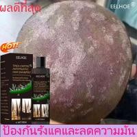 ราคา ยาสระผม แชมพู แชมพูสระผม แชมพูแก้ผมร่วง ผมร่วง แชมพูขจัดรังแค แชมพูลดผมร่วง ยาสระผมเชื้อรา ยาสระผมรังแค แชมพูทำความสะอาดเส้นผม ยาสระผมแก้ผมร่วง ยาสระผมขจัดรังแค ยาสระผมแก้เชื้อรา shampoo (20596856143)