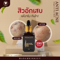 ราคา น้ำโสมแต้มสิวอักเสบ ฆ่าเชื่อสิว ฆ่าเชื้อสิวอักเสบ สิวอักเสบเป็นหนองยุบลง ลดอาการปวด บวม แดงของสิว MADAMKIKKE ANTI ACNE Ginger Thai Herb Essence มาดามกิ๊กกี้ (21011085008)
