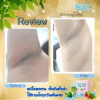 ราคา สบู่เร่งขาว เต่าขาว ผิวขาว เห็นผลภายใน 1 ก้อน (19999706951)