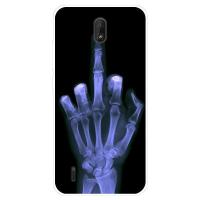ราคา สำหรับ Nokia C1 Case Soft TPU Nokia C1 NokiaC1ปลอกซิลิโคนการ์ตูนฝาครอบโทรศัพท์ (16635361294)