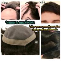 ราคา วิกผมชาย Mono Lace ปิดหัวล้าน วิกติดกาวผมแท้โมโนเลส ผมแท้100 เด่นเรื่องความทน แสกได้ทุกทิศทาง (15569145601)