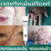 ราคา Vibrant Glamour ครีมลบแผลเป็น ครีมลบรอยแผลเป็น ครีมทาแผลเป็น ครีมรักษาแผลเป็น ลดรอยไหม้ น้ำร้อนลวก แผลผ่าตัด และรอยแผลเป็นอื่นๆ (17572830734)