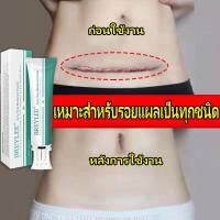 ราคา BREYLEE รอยแผลเป็น ครีมลบแผลเป็น ครีมทาแผลเป็น ครีมลดรอยแผลเป็น ยาแก้แผลเป็น แผลเป็น ลดแผลไฟไหม้ แผลน้ำร้อนลวก รอยสิว (17709254984)