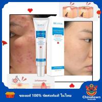ราคา ครีมลดสิว ของแท้100 พร้อมส่งจากไทย 30g สำหรับผิวที่เป็น สิว สิวผด ลดเลือนรอยสิว ครีมกำจัดสิว (20050628781)
