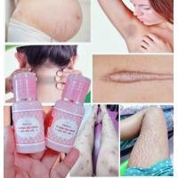 ราคา เซรั่มลบรอยแตก แตกลาย รอยสิว แตกลายหลังคลอด แผลเป็น คุ้มกว่าแนะนำขวดใหญ่ค่ะ ขนาด 30กรัม (20900304126)