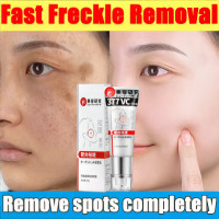 ราคา ครีมทาฝ้าหนาๆ TLครีมรักษาฝ้า ครีม แก้ ฝ้า กระ 20g ครีมแก้ฝ้ากระ ป้องกันริ้วรอย ดูกระจ่างผิวใส ทาฝ้าหนาลึก ครีมทาผิวกระ กระ ครีมไวท์เทนนิ่ง ช่วยลดฝ้า กระ จุดด่างดำ ริ้วรอย รอยแดง ไวท์เทนนิ่งครีม บำรุง 