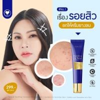 ราคา ครีมยางลบ ลดรอยแดง ลดความมัน เพิ่มความชุ่มชื้น เหมาะสำหรับผิวแพ้ง่าย MADAMKIKKE Soothing Clear Acne Cream มาดามกิ๊กกี้ (21068673456)