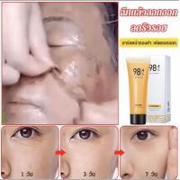 ราคา Bellin Beauty Gold Peel off Mask ขัดผิว สิวหัวดำ ทำความสะอาดผิวหน้าอย่างล้ำลึก ผลิตภัณฑ์ดูแลผิว 24k Gold Mask80ml (21224331353)