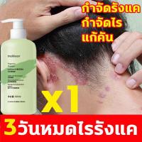 ราคา meikieen แชมพูขจัดรังแค 500ml ยาสระผมเชื้อรา ขจัดรังแค ยารักษารังแค หยุดอาการคัน ยาสระผมแก้เชื้อรา ควบคุมน้ำมัน ยาสระผมเชื้อรา กำจัดไร ยาสระผมรังแค ยาสระผมแก้คัน สระผมเหมือนฉีดน้ำหอม shampoo (21173845