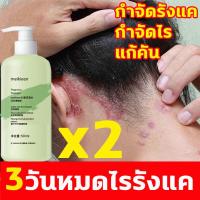 ราคา meikieen แชมพูขจัดรังแค 500ml ยาสระผมเชื้อรา ขจัดรังแค ยารักษารังแค หยุดอาการคัน ยาสระผมแก้เชื้อรา ควบคุมน้ำมัน ยาสระผมเชื้อรา กำจัดไร ยาสระผมรังแค ยาสระผมแก้คัน สระผมเหมือนฉีดน้ำหอม shampoo (18297073