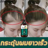 ราคา พร้อมส่ง ZENSHOW เซรั่มยาสระผมขิง แชมพูแก้ผมร่วง 500ml ทำความสะอาดผม ฟื้นฟูตัวเอง แชมพู แชมพูขิงเพียว ยาสระผมขิง แชมพูขิง เซรั่มขิงบำรุงผม เซรั่มแก้ผมร่วง เซรั่มปลูกผม แชมพูปลูกผมดก แชมพูลดผมร่วง แชม 