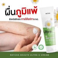ราคา ครีมทาเชื้อราผิวหนัง Ultra U อัลตร้ายู ครีมทาเชื้อรา สะเก็ดเงิน เล็บ กลาก เกลื้อน น้ำกัดเท้า คันง่ามเท้า ครีมทาแก้คัน คันในร่มผ้า หลอด 30 g (20887426959)