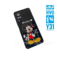 ราคา Case Vivo Y31 เคส Vivo Y31 เคสนิ่มทั้งตัว ปกป้องเลนส์กล้อง ปกป้องตัวเครื่อง ลายการ์ตูน งานสวย เคส Vivo เคส Y31 (13344682436)