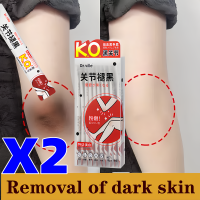 ราคา จัดส่งวันนี้ ครีมทาขาหนีบดำครีมทารักแร้ ขาหนีบ ง่าม ข้อพับ Underarm White Booster ผิวดูกระจ่างใส เรียบเนียน พร้อมเบลอผิวทันที รักแร้ดำ ครีมทาขาหนีบ ผิวขาว ครีมทาผิว ครีมทารักแร้ ขาหนีบ หลังคอ บำรุงผิ 