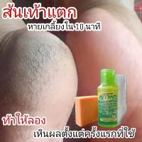 ราคา น้ำยาสมุนไพรขัดส้นเท้าแตก สปาเท้าแตกสุภาพร 60ml ฟรี ถุงมือ สำลี โฟมขัด (19793805748)