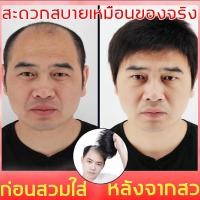 ราคา ผมปลอม เบาและระบายอากาศ เสริมปริมาณจำนวนเส้นผม ดูเหมือนตัวจริง วิกผมชายวัยกลางคน วิกผมผู้ชาย วิกผมปลอม วิกผมสำหรับผู้ชาย วิกผมชาย วิกผมชายสั้น ชายวิกผมผู้ชายวิกผม วิกผมสั้นผู้ชาย วิกผมสั้นผู้ชาย ผมจริ