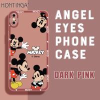 ราคา Hontinga เคสโทรศัพท์ iPhoneเคสมือถือสำหรับ iPhone X XS XR XS MAX ฝาหลังซิลิโคนนิ่มสี่เหลี่ยมลายการ์ตูนมิกกี้เมาส์เคสป้องกันกล้องกันกระแทกเคสยางเคสโทรศัพท์แบบนิ่มสำหรับเด็กผู้หญิง (14860161445)