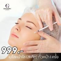 ราคา Digital Coupon Gakeri Clinic Meso หน้าใส 999 THB ดิจิตัลคูปอง กาเกริ คลินิก เมโสหน้าใส ทั่วใบหน้า 999 บาท (19411602045)