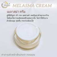 ราคา เมลาสม่า ครีม (21322145065)