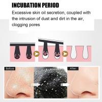 ราคา CW 50 10Pcs Blackhead Remover Mask Nose Strips Dot Spot Peel Off Stickers Acne Treatment Face Pore Cleaner Masks (17218408130)