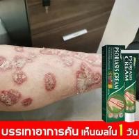 ราคา ยาทาแก้คัน แก้คัน ตุ่มเหงื่อ ผื่นผิวหนัง อับชื้น ผด ครีมทาภายนอก 20g (21341275054)