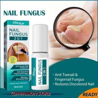 ราคา Nail Fungal Solution Foot Nail Fungus Removal Gel Anti infective Paronychia Onychomycosis Repair Essence Finger Toenail Fungus Treatment Serum Toe Fungal Fix and Renew Cuticle Thickening Nail Repair L