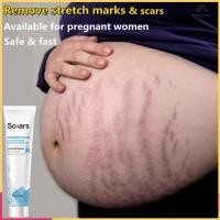 ราคา ครีมป้องกันรอยแตกงาครีมทาลดรอยแผลเป็นสำหรับคนท้องขนาด20กรัมสามารถกำจัดเต้านมท้องเอวรอยแตกลายได้อย่างปลอดภัย (17861101339)