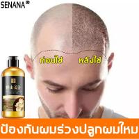 ราคา SENANA แชมพูขิงเพียว 300ml แชมพูขิง แชมพูเร่งผมยาว สกัดจากขิงสด รากผมแข็งแรง บำรุงแส้นผมให้ราบรื่นเงาดำ แชมพูปลูกผมดกสำหรับผมบาง แชมพูแก้ผมร่วง แชมพูลดผมร่วง แชมพูขจัดรังแค แชมพูผมร่วง แชมพูขิงของแท้ 