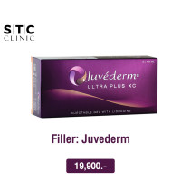 ราคา E voucher ฟิลเลอร์ Juvederm 1 cc (18892457709)