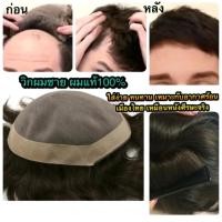 ราคา วิกผมชาย Mono Lace ปิดหัวล้าน วิกติดกาวผมแท้โมโนเลส ผมแท้100 เด่นเรื่องความทน แสกได้ทุกทิศทาง (15569145597)