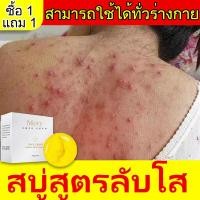 ราคา ซื้อ 1 แถม 1 สบู่กำจัดไร 100g สบู่ลดสิวหน้า สบู่ล้างหน้า สบู่หน้าขาวใส สบู่ผิวขาว สบู่สูตรลับโสม สบู่อาบน้ำ ล้างให้มีผิวสวยใสไร้สิวออกม (15881716125)