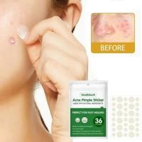 ราคา แผ่นแปะสิว ซับสิว ดูดสิว West month acne pimple sticker (20891381157)