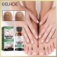 ราคา Eelhoe Repair Nail Fungus Treatments Essence Foot Care Serum Toe Nails Fungal Removal Gel Anti Infection Onychomycosis Essence Serum Care Nails Fungal Removal Repair Hand And Foot Care 30Ml (165013881
