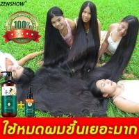 ราคา ขายร้อ ZENSHOW ยาสระผมเร่งยาว แชมพูแก้ผมร่วง แชมพูขิง 500ml ขิงช่วยป้องกันผมร่วง สูตรน้ำขิง บำรุงรากผม แชมพูขิงของแท้ แชมพูขิงเพียว แชมพูปลูกผมดก ยาสระผมแก้ร่วง แชมพูลดผมร่วง แชมพูขจัดรังแคแชมพูสระผม 