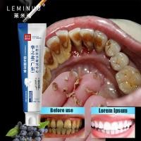 ราคา ยาสีฟันขจัดหินปูน100gยาสีฟันฟอกฟันขาว ยาสีฟันฟันขาว ช่องปาก ยาสีฟันหินปูน ยาสีฟันจัดฟันฟันขาว ยาสีฟันขจัดหินปูน ยาสีฟันขาว กําจัด (21274530348)