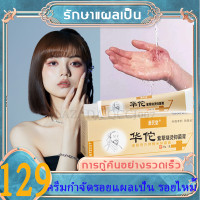 ราคา ช่วยให้แผลไฟไหม้น้ำร้อนลวกและรอยแผลเป็นหายสนิท ครีมทาแผลน้ำร้อนลวก ครีมทาน้ำร้อนลวก ครีมทาแผลไฟไหม้ ครีมรักษาแผลเป็น ลด รอย แผลเป็น ไหม้ ครีมลดแผลไฟไหม้ ครีมกำจัดรอยแผลเป็น รอยไหม้ (18675193056)