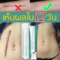 ราคา Breylee ครีมลดแผลเป็น รีมทาแผลเป็น ลบรอยแผลถาวร ครีมทาแผลผ่าคลอด ยาทาแผลคีลอยด์ ลดแผลไฟไหม้ แผลน้ำร้อนลวก รอยสิว แผลผ่าตัดเป็นต้น ให้คุณมีผิวขาวกระจ่างใส (16283314858)