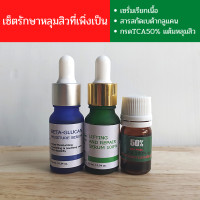 ราคา 2 แถม 1 เซรั่มเรียกเนื้อหลุมสิว Lifting and Repair Serum 100 ลดหลุมสิว หน้าเรียบเนียน ผิวขาวใส อิ่มน้ำ (19046831924)