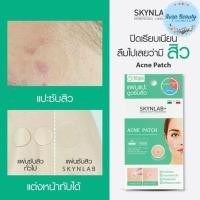 ราคา แผ่นแปะสิว สกินแล๊บ Skynlab Acne Patch 10 ชิ้น (20316683879)