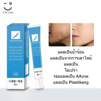 ราคา 20g ครีมซ่อมแซมแผลเป็น ซีซาร์ แผลเป็น แผลเป็น รอยแผลเป็น รอยสิว เครื่องหมายกำจัด (13960601628)