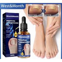 ราคา น้ำมันฆ่าเชื้อราที่เล็บลดปวดบวมอักเสบ Removal paronychia oil ฆ่าเชื้อราที่เล็บ รักษาเชื้อราเล็บ ช่วยซ่อมแซมเล็บ น้ำยาต้านเชื้อรา ขจัดโรคเชื้อราที่เล็บ ยาฆ่าเชื้อราที่เล็บ (19149808141)