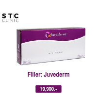 ราคา E voucher ฟิลเลอร์ Juvederm 1 cc (18892457708)