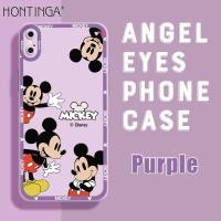 ราคา Hontinga เคสโทรศัพท์ iPhoneเคสมือถือสำหรับ iPhone X XS XR XS MAX ฝาหลังซิลิโคนนิ่มสี่เหลี่ยมลายการ์ตูนมิกกี้เมาส์เคสป้องกันกล้องกันกระแทกเคสยางเคสโทรศัพท์แบบนิ่มสำหรับเด็กผู้หญิง (14860161443)