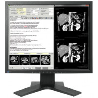 ราคา Monitor EIZO RadiForce MX194 (667ce7c0aea7dea337330bbc)