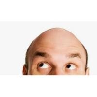 ราคา Finasteride5 mg/wิไรด์5 รักษาผมร่วงในชาย (4เดือน) กล่องขาว-น้ำเงิน (3035498445)