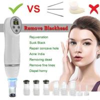 ราคา เครื่องดูดสิว สิวเสี้ยน อุดตัน (728441807)