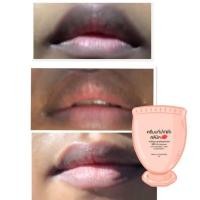 ราคา ครีมแก้ปากดำคลีนิค หายดำถาวร (11736238512)
