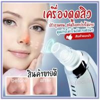 ราคา เครื่องดูดสิวเสี้ยน KM-1867 อุปกรณ์ดูดสิวเสี้ยน กำจัดสิวเสี้ยนจมูก ดูดสิวที่จมูก แรง 3 ระดับ/ เครื่องล้างหน้าแบบซิลิโคลน (16478202875)