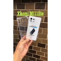 ราคา ✨✨รุ่นใหม่ล่าสุด✨✨พร้อมส่งในไทยเคสใสกันกระแทกคลุมกล้อง xiaomi mi11lite (2951970912)