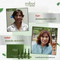 ราคา mfeel spongilla serum Micro-Needle-Serum (3171395395)